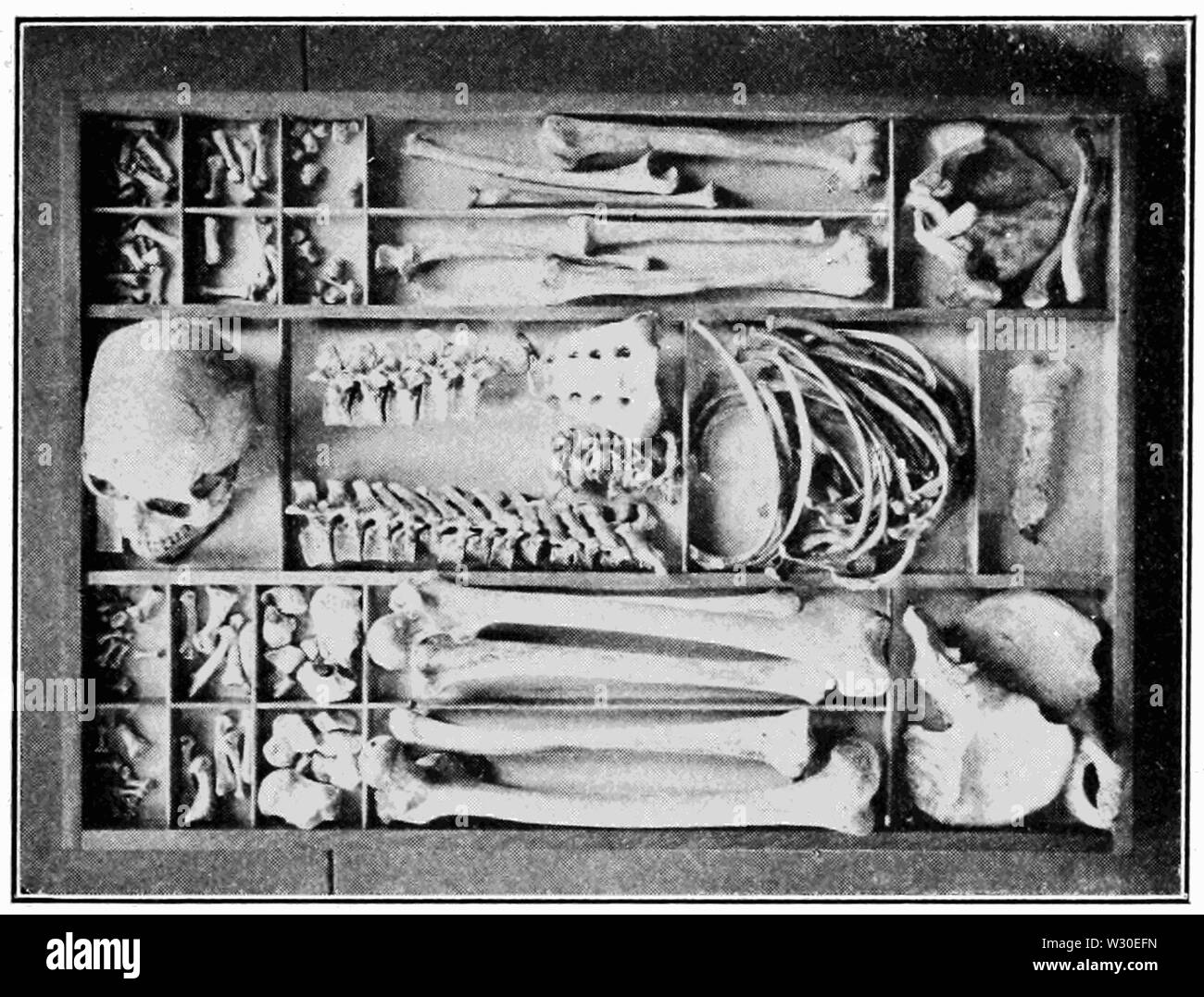 PSM V67 D195 Metodo di memorizzazione di uno scheletro umano nel vassoio Foto Stock