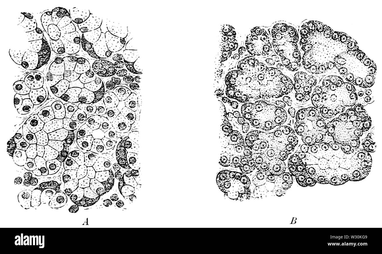 PSM V71 D113 ghiandole orbitale prima e dopo la secrezione prolungata Foto Stock