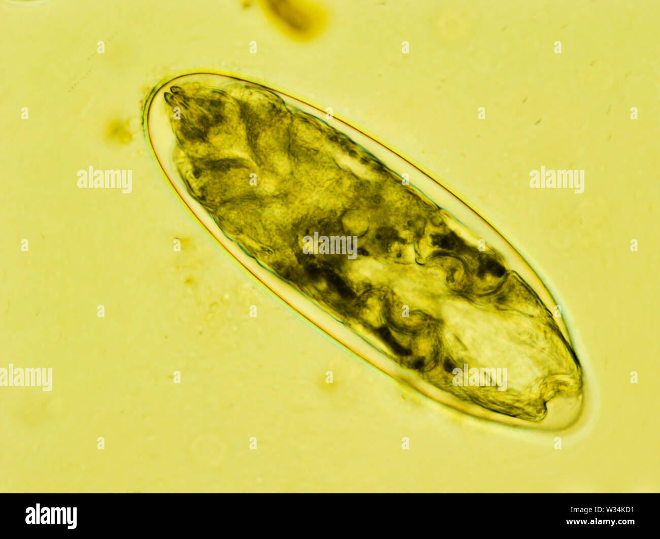 Flea uovo con la larva all'interno sotto il microscopio Foto Stock