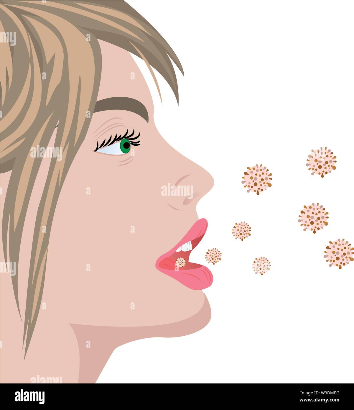 Infezione causata da virus influenzali sovracrescita batterica producendo un cattivo odore di respirare in una bocca illustrazione vettoriale su sfondo bianco Illustrazione Vettoriale
