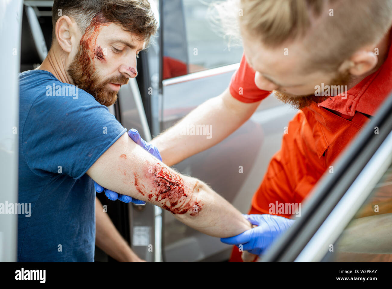 Lavoratore di ambulanza esaminando profonde ferite del braccio di un uomo seduto vicino la vettura dopo l'incidente stradale, fornendo assistenza medica d'emergenza Foto Stock
