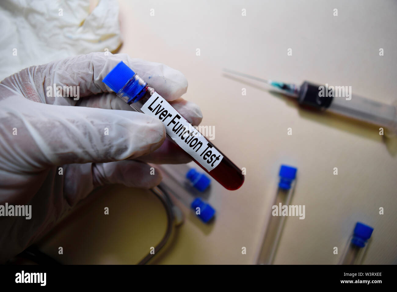 La funzione epatica testo di prova su foglietti adesivi. Vista superiore isolata sulla scrivania in ufficio. Assistenza sanitaria/concetto medico Foto Stock