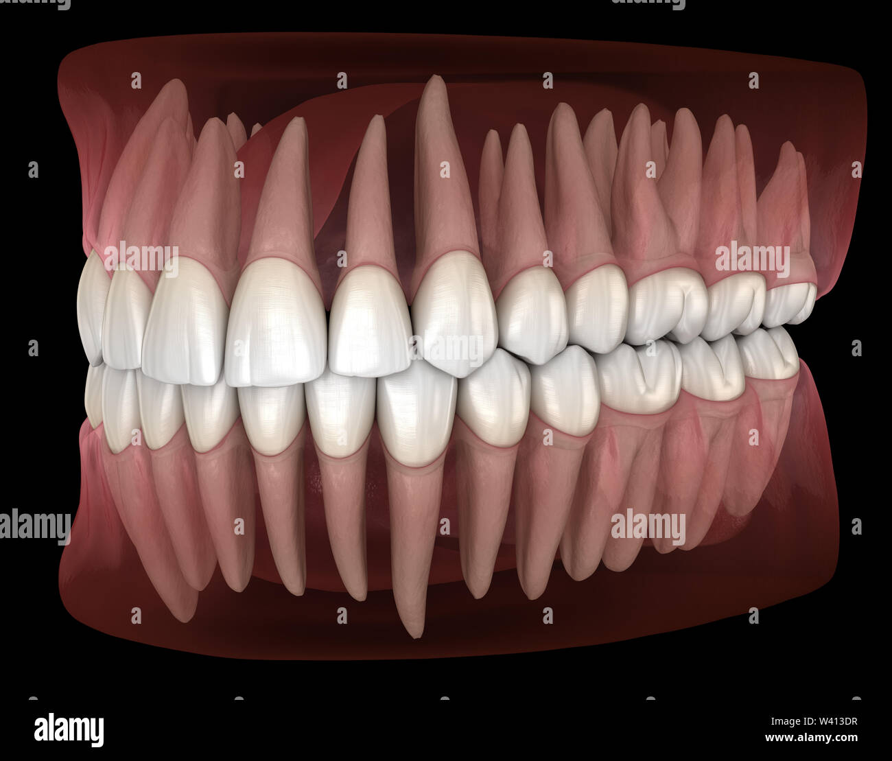 Tenuta Della Mano Del Dentista Del Modello Della Mandibola Dei Denti E Della Pulizia W Dentario