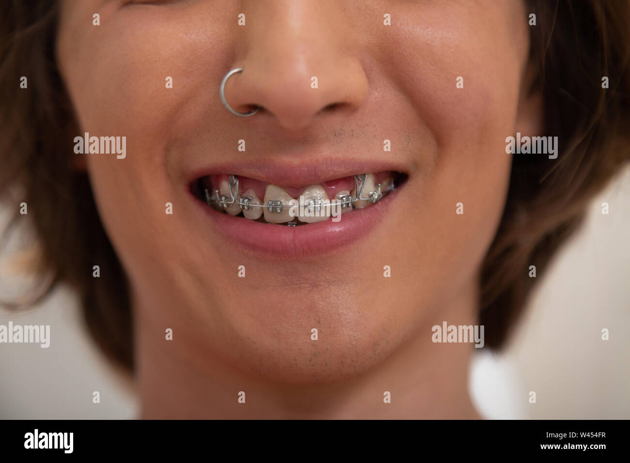 Oral piercing immagini e fotografie stock ad alta risoluzione - Alamy