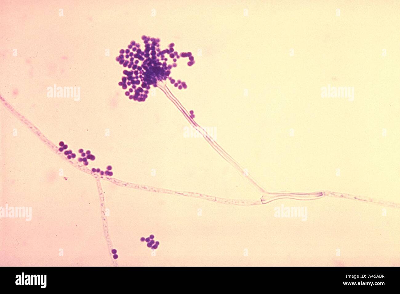 Conidi phialoconidia di Aspergillus fumigatus FIL 300 lores. Foto Stock