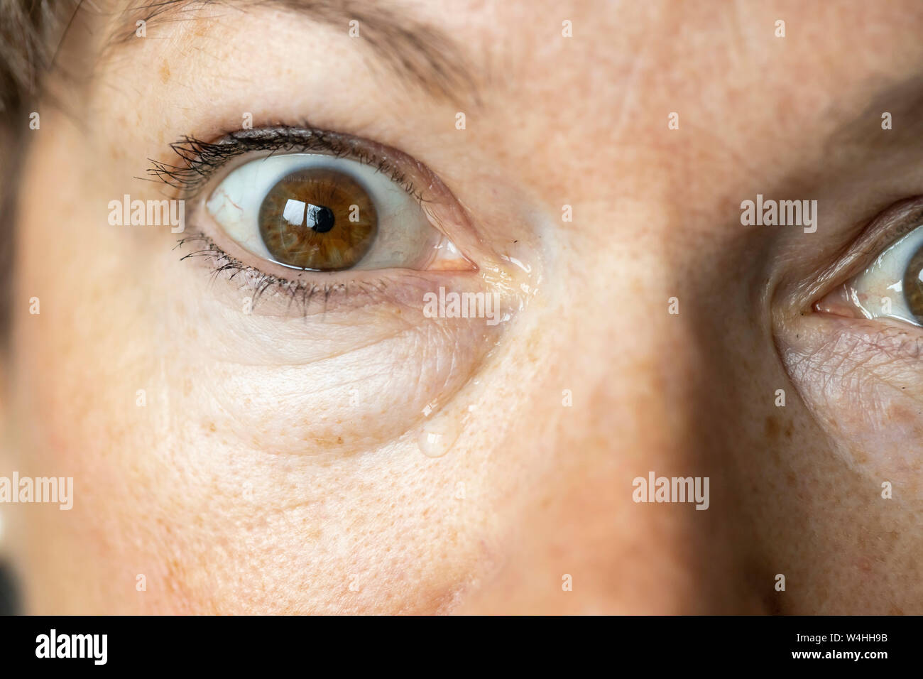 Occhio, lacrime, tofu occhio, Foto Stock