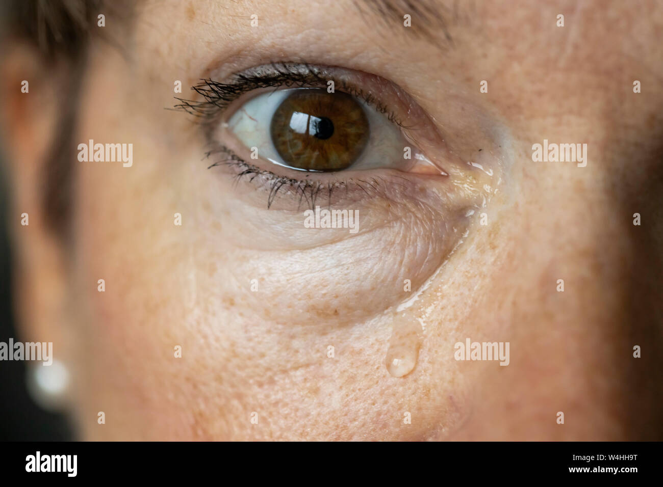 Occhio, lacrime, tofu occhio, Foto Stock