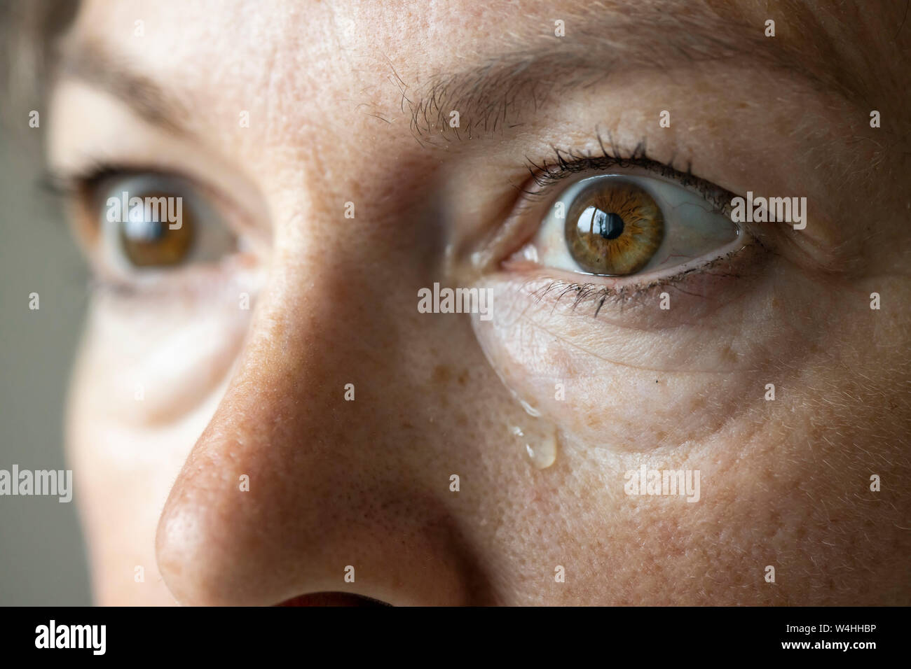 Auge, Tränen, tränendes Auge, Foto Stock