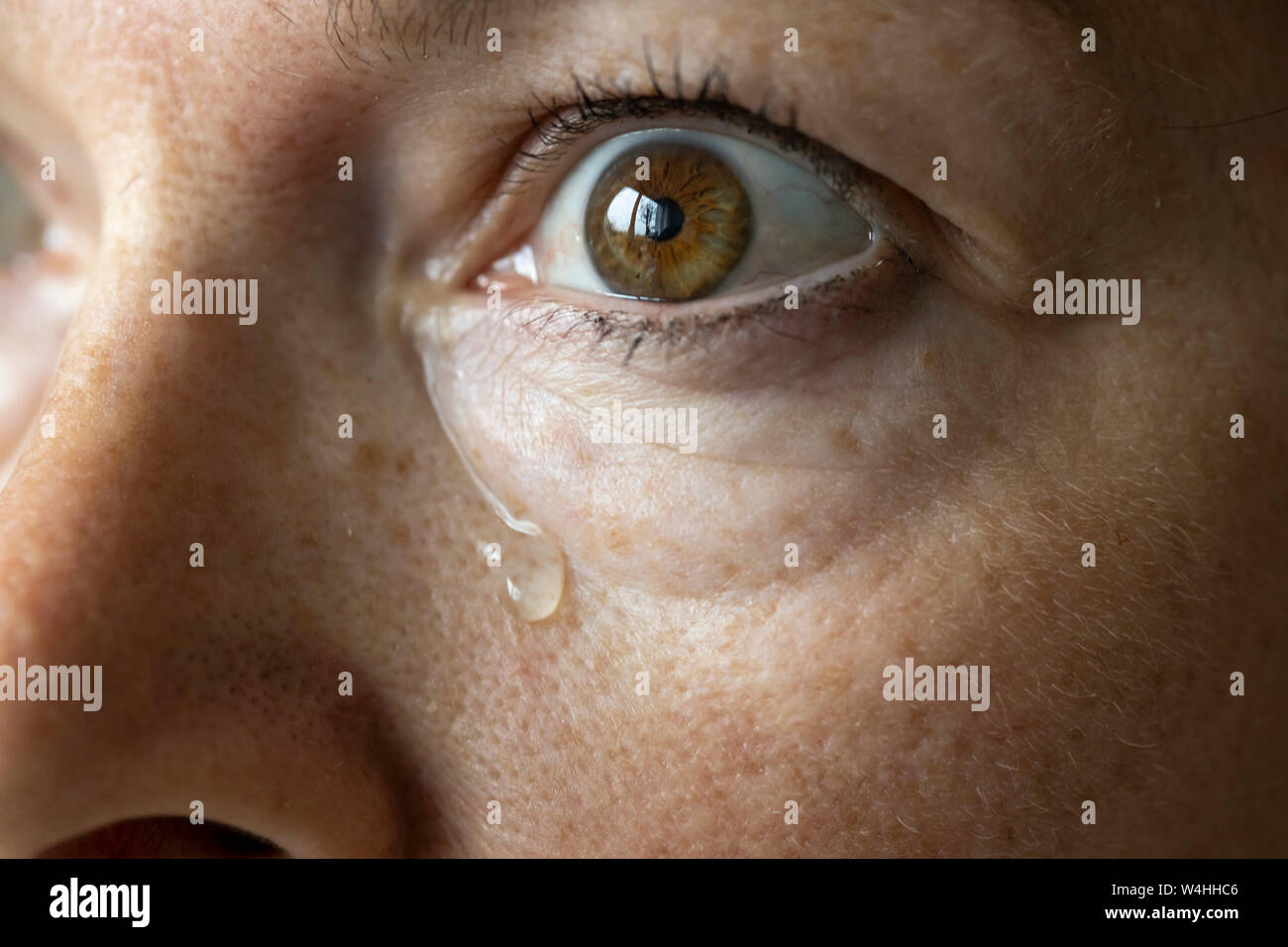 Occhio, lacrime, tofu occhio, Foto Stock