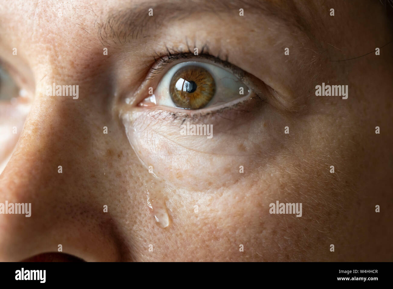 Occhio, lacrime, tofu occhio, Foto Stock