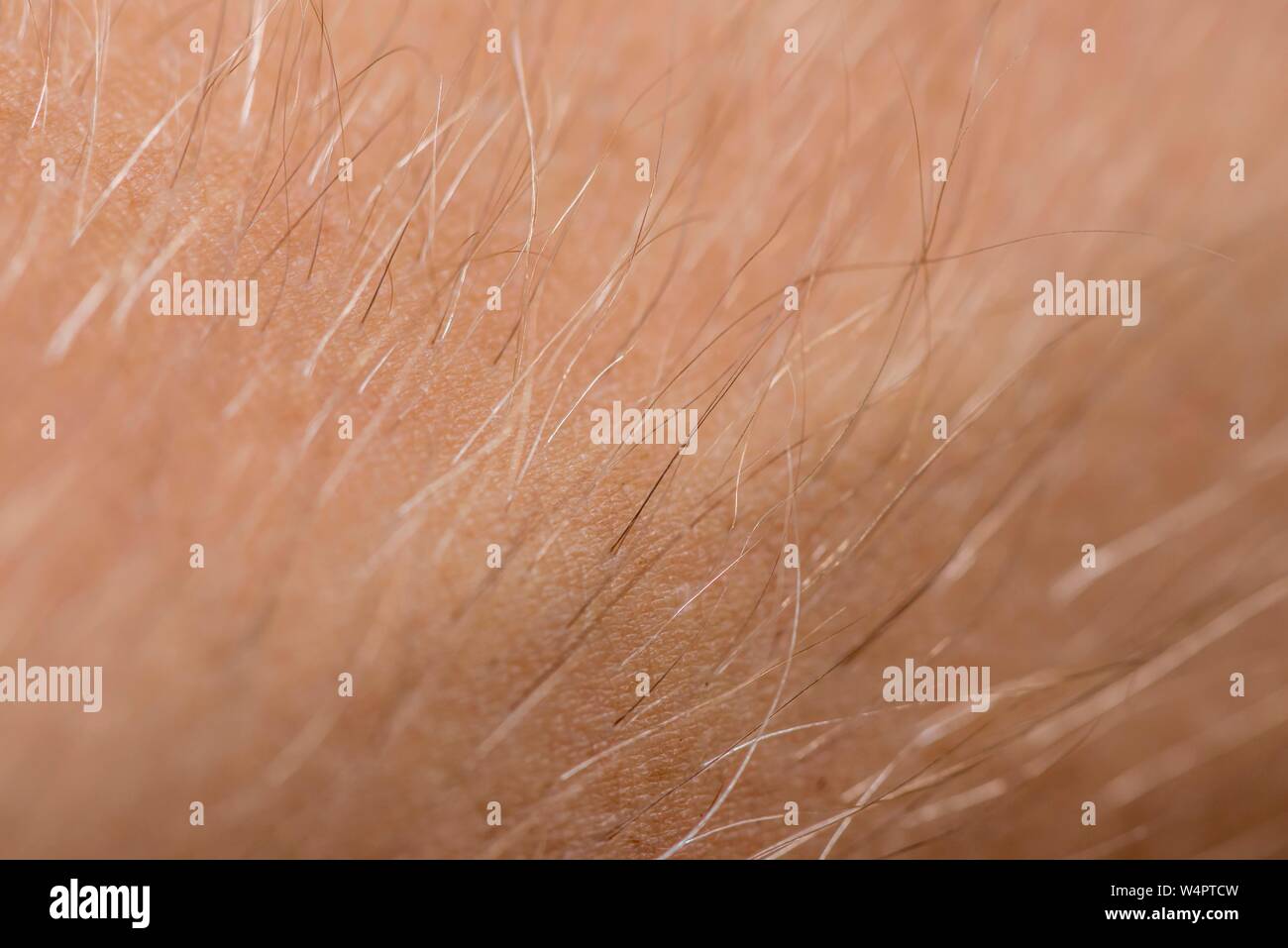 Pelle con pelo, pelosità, macro, Germania Foto Stock