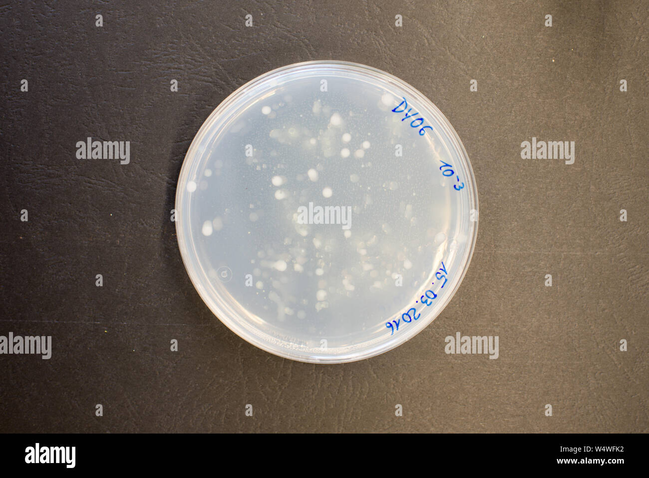 Le colonie di batteri sulla piastra di agar in un laboratorio di ricerca Foto Stock