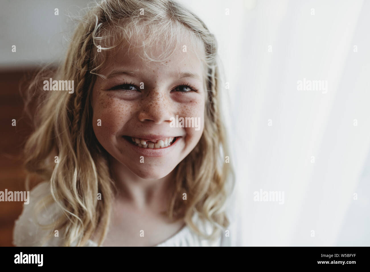 Ritratto di giovane freckled sorridente ragazza dente mancante Foto Stock