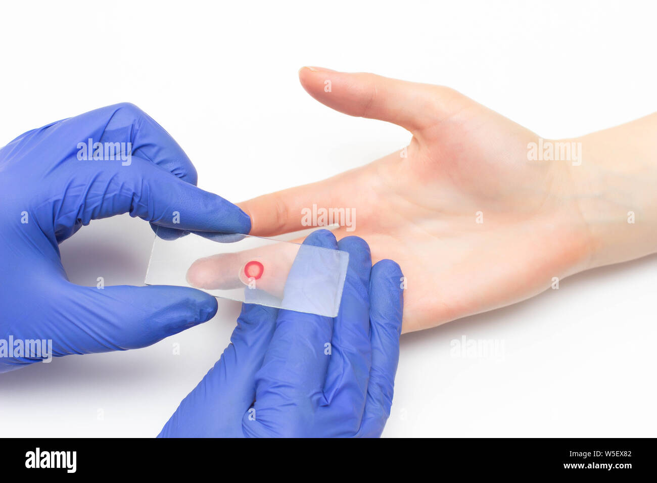 Il medico prende il sangue dal suo dito generale analisi cliniche per lo studio del sangue del sistema immunitario e di plasma, close-up, immunoglobuline, Foto Stock