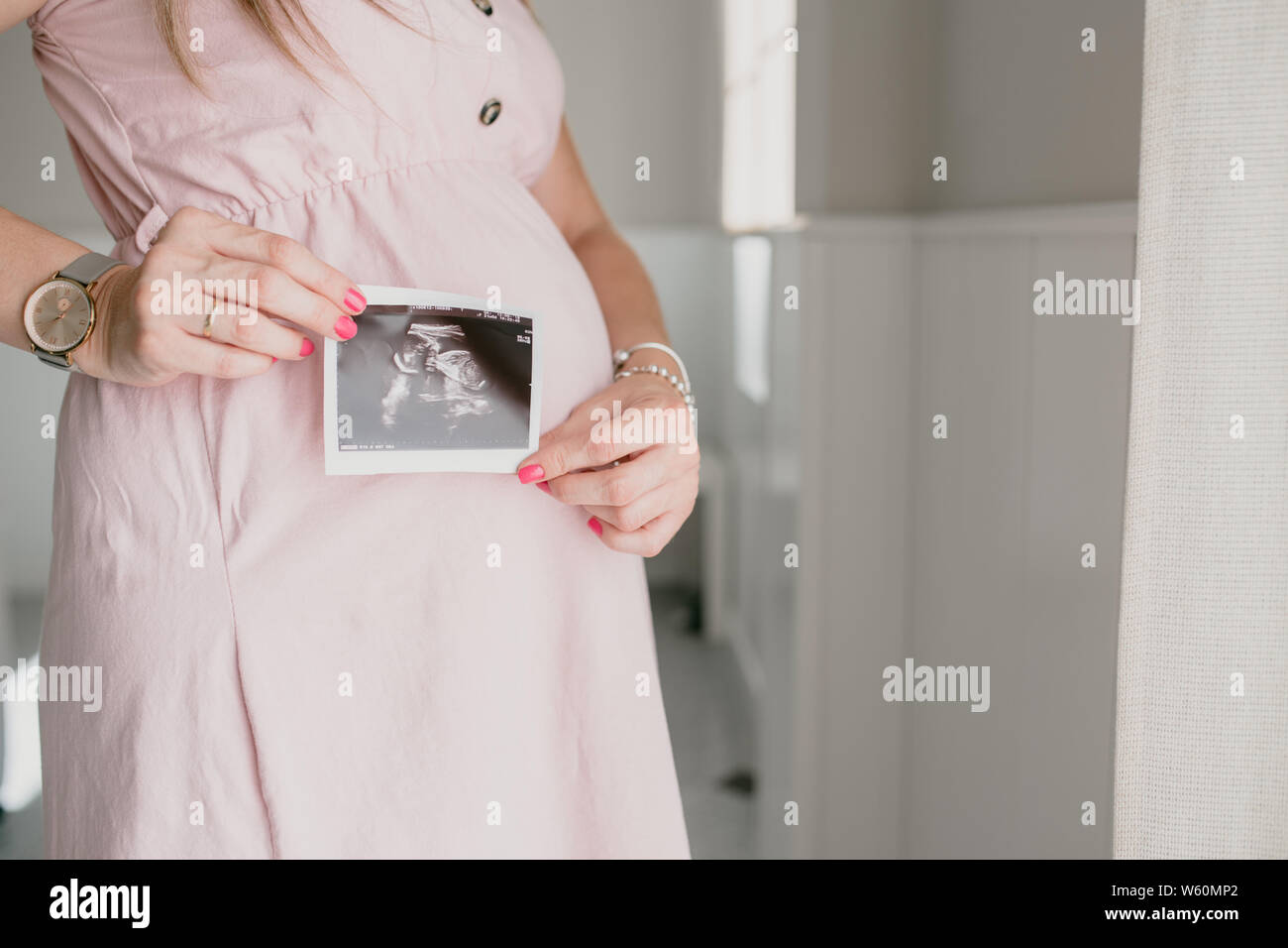 Donna incinta che mostra una ecografia, per lato Foto Stock