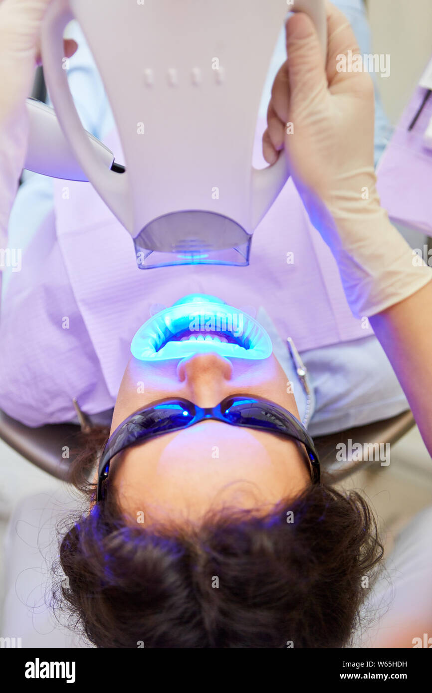 Luce LED blu è usato professionale per lo sbiancamento dei denti dal dentista Foto Stock