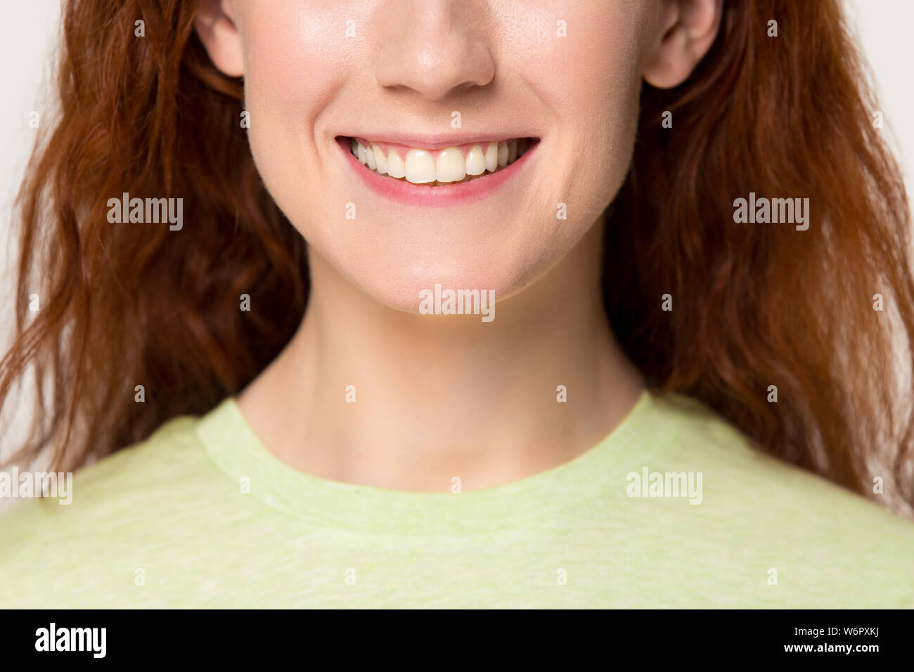 Closeup caucasian red-headed woman avente ultra bianco sorriso toothy Foto Stock