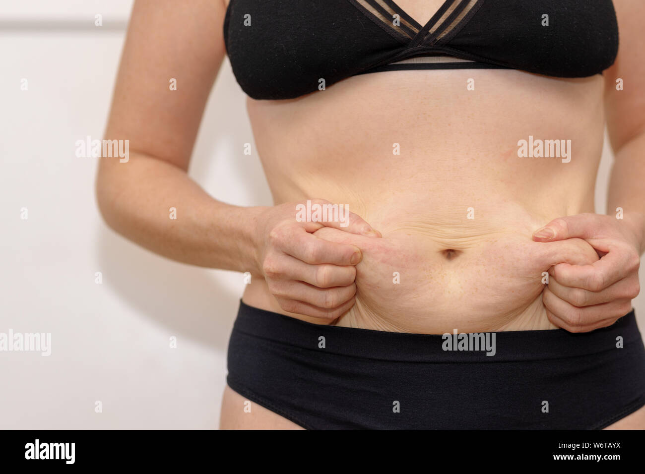 Il grasso ventre femminile, donna che mantiene la sua pelle per controllare la cellulite. Sbarazzarsi del ventre grasso e perdita di peso. Le donne il grasso corporeo pancia vista anteriore Foto Stock