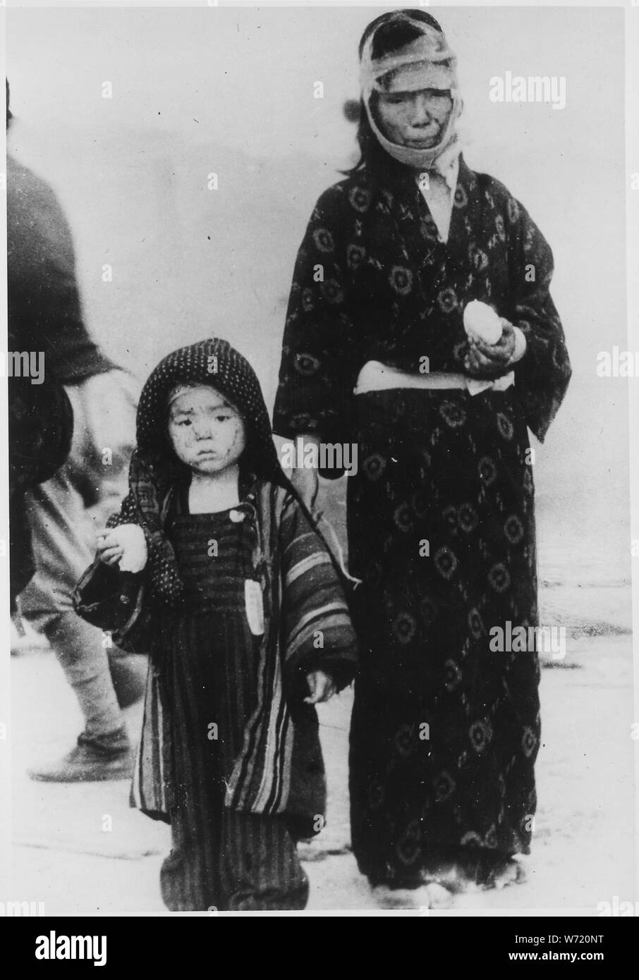 Prima di mezzogiorno il 10 agosto 1945, una madre e suo figlio hanno ricevuto un riso bollito palla da un rilievo di emergenza parte. Un miglio a sud-est di Ground Zero, di Nagasaki Foto Stock