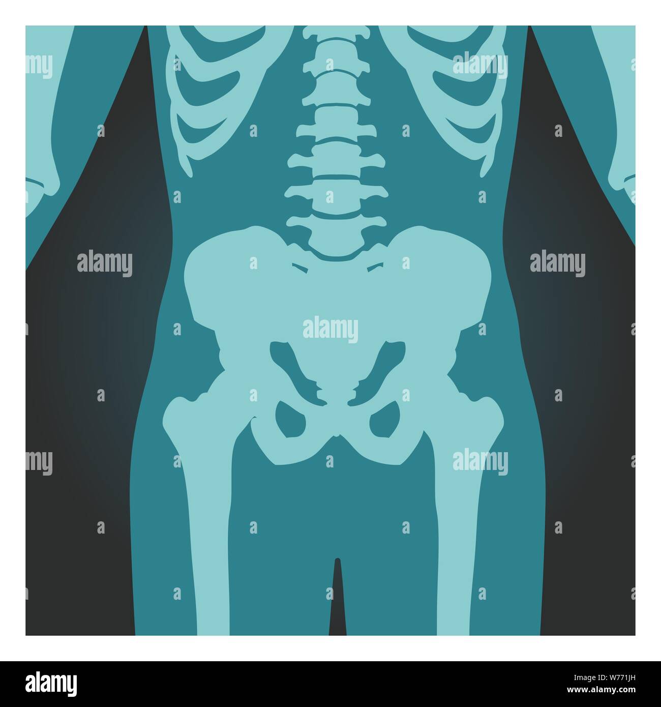 X-ray colpo di bacino e la colonna vertebrale, corpo umano le ossa, radiografia, illustrazione vettoriale. Illustrazione Vettoriale