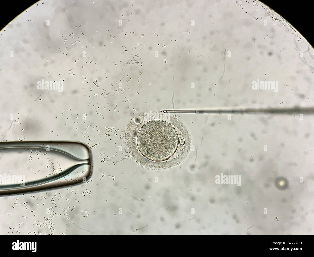 Primo piano attraverso il microscopio il processo della fecondazione in vitro di una femmina uovo all'interno di IVF piatto in laboratorio. Orizzontale. Foto Stock