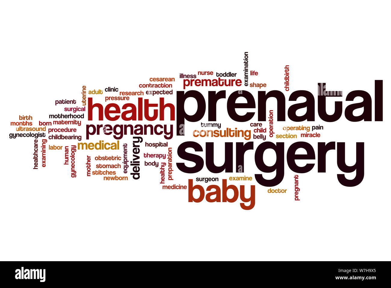 La chirurgia prenatale parola concetto di cloud Foto Stock