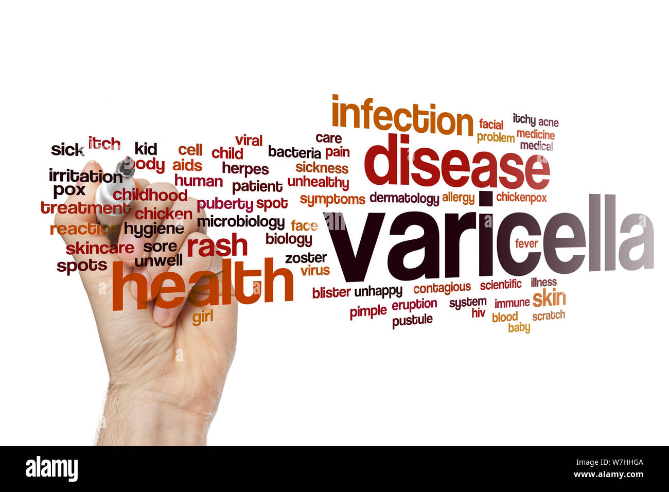 Varicella word cloud Foto Stock