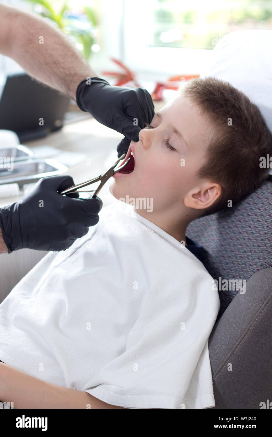 Il dentista le mani in nero guanti di gomma tenere le tenaglie per tirare i denti. Il ragazzo con gli occhi chiusi si siede tranquillamente in poltrona con la bocca aperta. Foto Stock