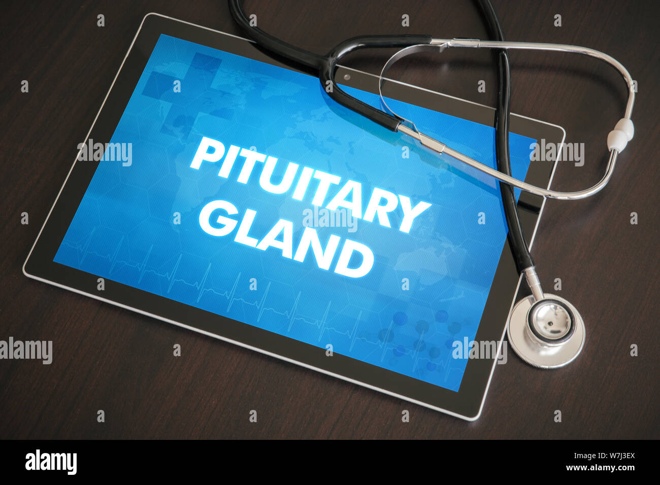 Ghiandola pituitaria (malattie endocrine connesse) diagnosi concetto medico su tablet schermo con stetoscopio. Foto Stock