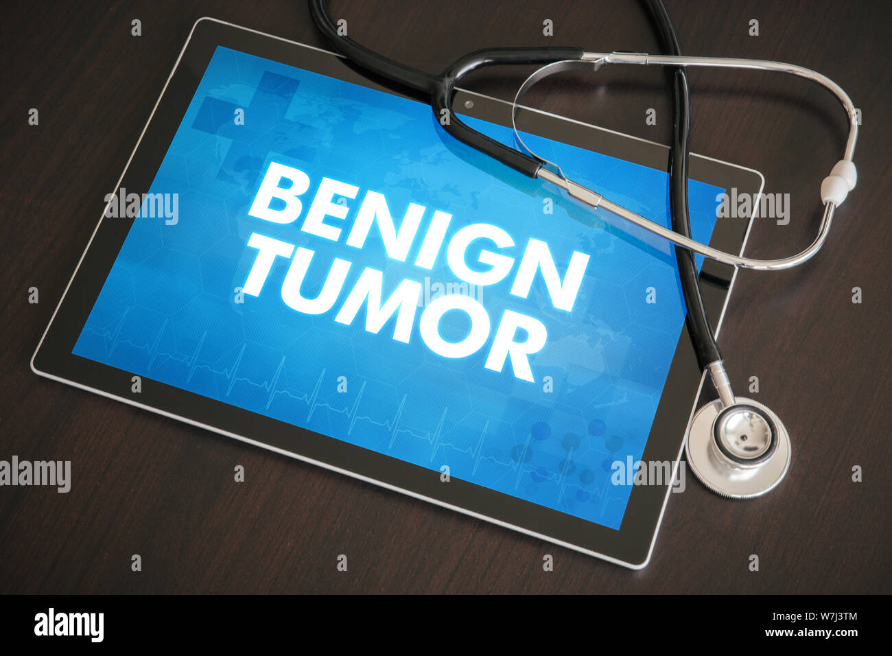 Tumore benigno (cancro correlati) diagnosi concetto medico su tablet schermo con stetoscopio. Foto Stock
