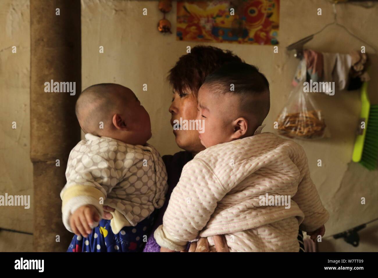 Madre cinese Xu Shijia, che hanno utilizzato un sistema di lotteria di decidere a quale dei suoi gravemente malato gemelli per salvare perché lei non può pagare per entrambi, porta twin b Foto Stock