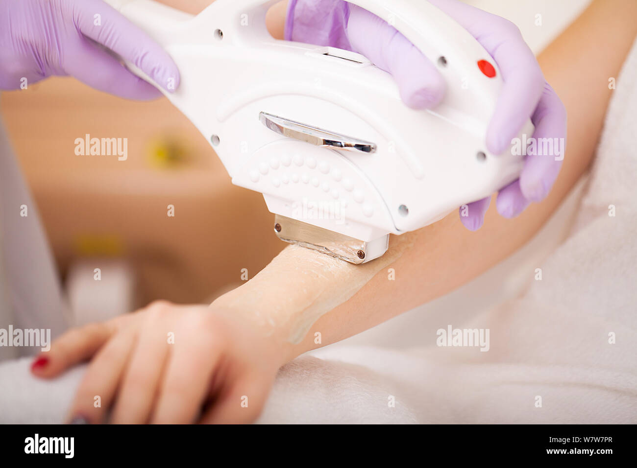 La cura della pelle. Le mani di epilazione laser e cosmetologia. La  rimozione dei peli cosmetologia procedura Foto stock - Alamy