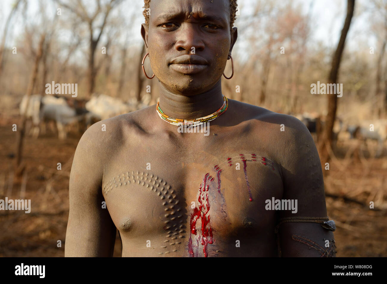Giovane uomo dalla Bodi tribù con nuove cicatrici sul suo petto. Valle dell'Omo, Etiopia, marzo 2015.. Foto Stock