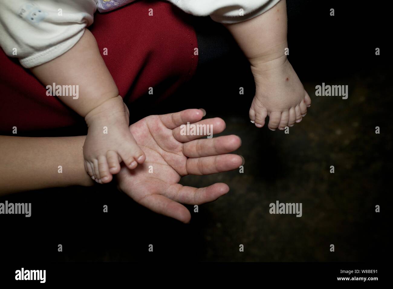 I piedi di tre-mese-vecchio baby boy Hong Hong che ha 15 dita e 16 le dita  dei piedi sono mostrati da sua madre polydactyl chi ha dita 12 e 12 dita a