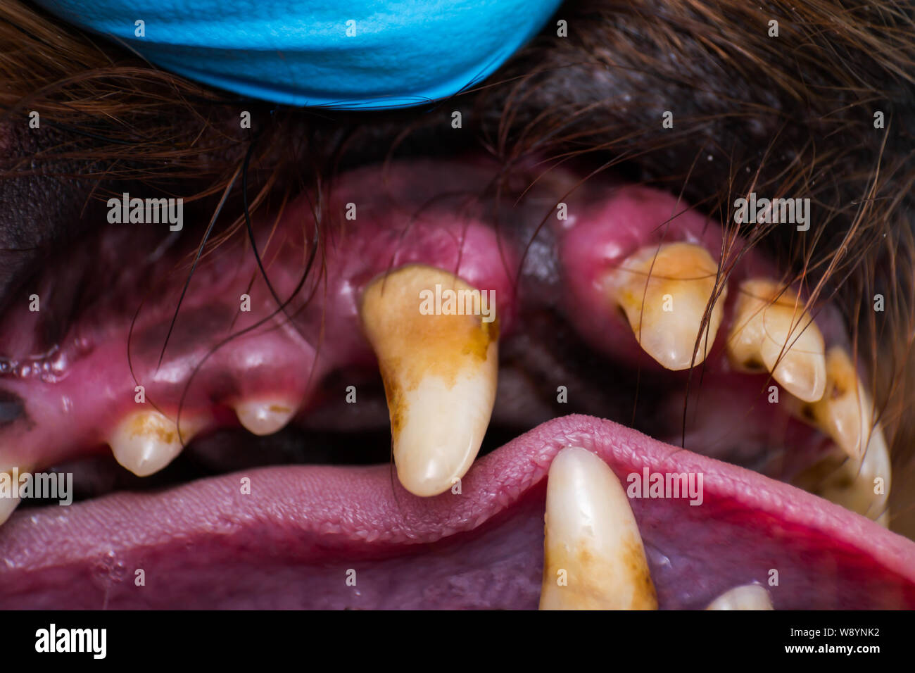 Close-up foto di denti di innesto con la placca batterica o tartaro Foto Stock