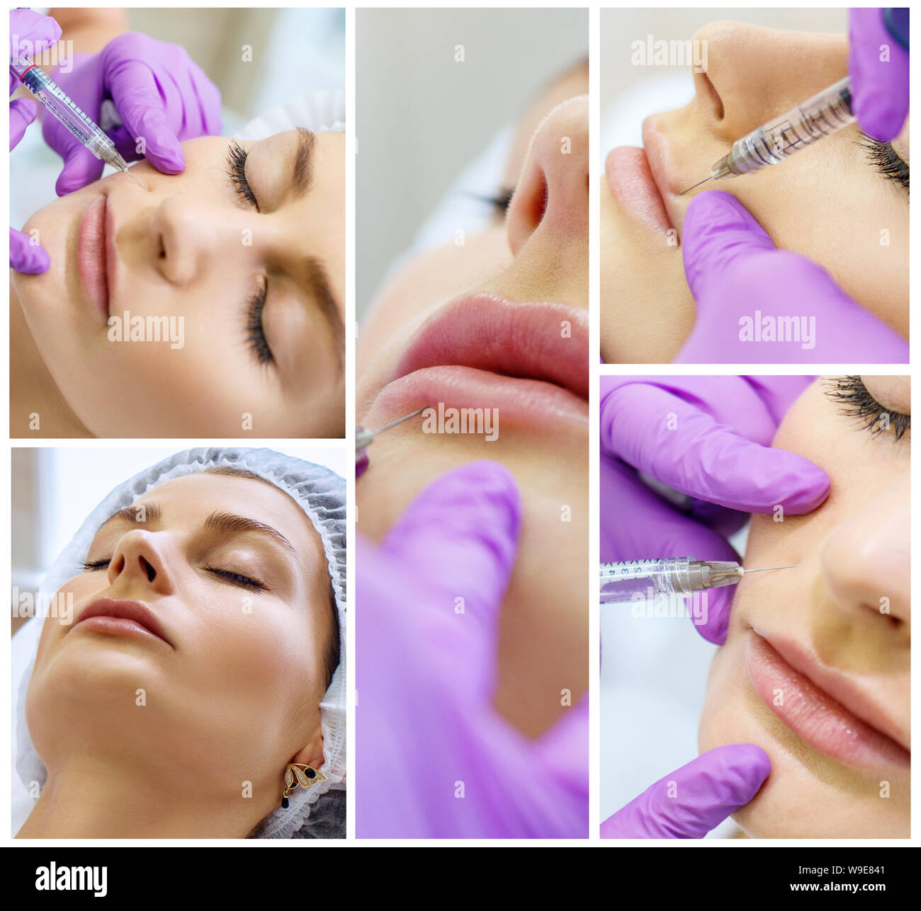 Collage di bella ragazza sulla procedura di ringiovanimento nella clinica di bellezza. Foto Stock