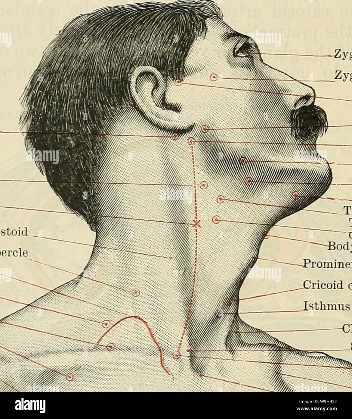 Immagine di archivio da pagina 1423 di Cunningham il libro di testo di anatomia (1914). Cunningham il libro di testo di anatomia cunninghamstextb00cunn Anno: 1914 ( ygomatie processo di Zygoma frontale arteria temporale del nervo facciale processo trasversale di atlas esterna arteria mascellare sottomascellari premistoppa ---anteriore del ventre digastric - Punta di maggiore cornu di osso hyoid suggerimento di superior cornu di cartilagine thyreoid corpo di osso hyoid -Prominentia laryngea cartilagine ricoid  istmo di thyreoid premistoppa --Clavicular capo di sterno-mastoide testa sternale di sterno-mastoide 232"b". La biforcazione della arteria innominate -Infra-clavic Foto Stock