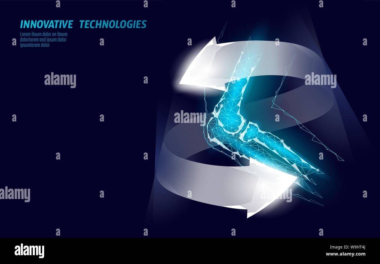Umano giunto a gomito modello 3d illustrazione vettoriale. Bassa poli design tecnologia futura curare dolore al braccio di trattamento. Cura di recupero incandescente freccia medicina di gel Illustrazione Vettoriale