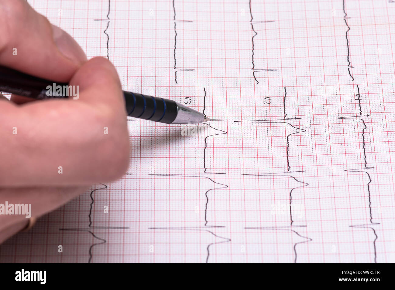 Carta ECG rapporto grafico, elettrocardiogramma su modulo cartaceo come sfondo Foto Stock