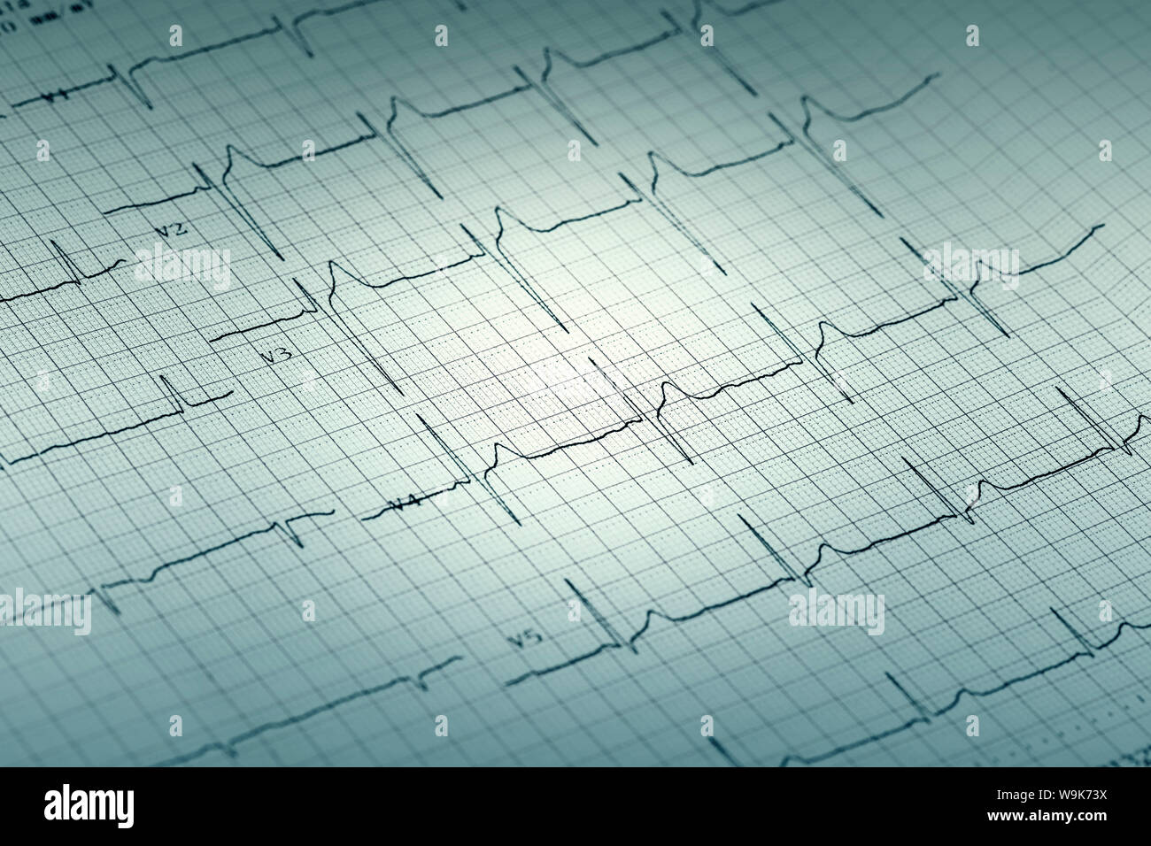 Carta ECG rapporto grafico, elettrocardiogramma su modulo cartaceo come sfondo Foto Stock