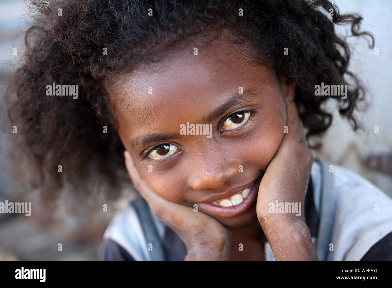Bella ragazza in Morondava, Madagascar. A causa della persistente crisi politica in Madagascar è tra i paesi più poveri del mondo Foto Stock