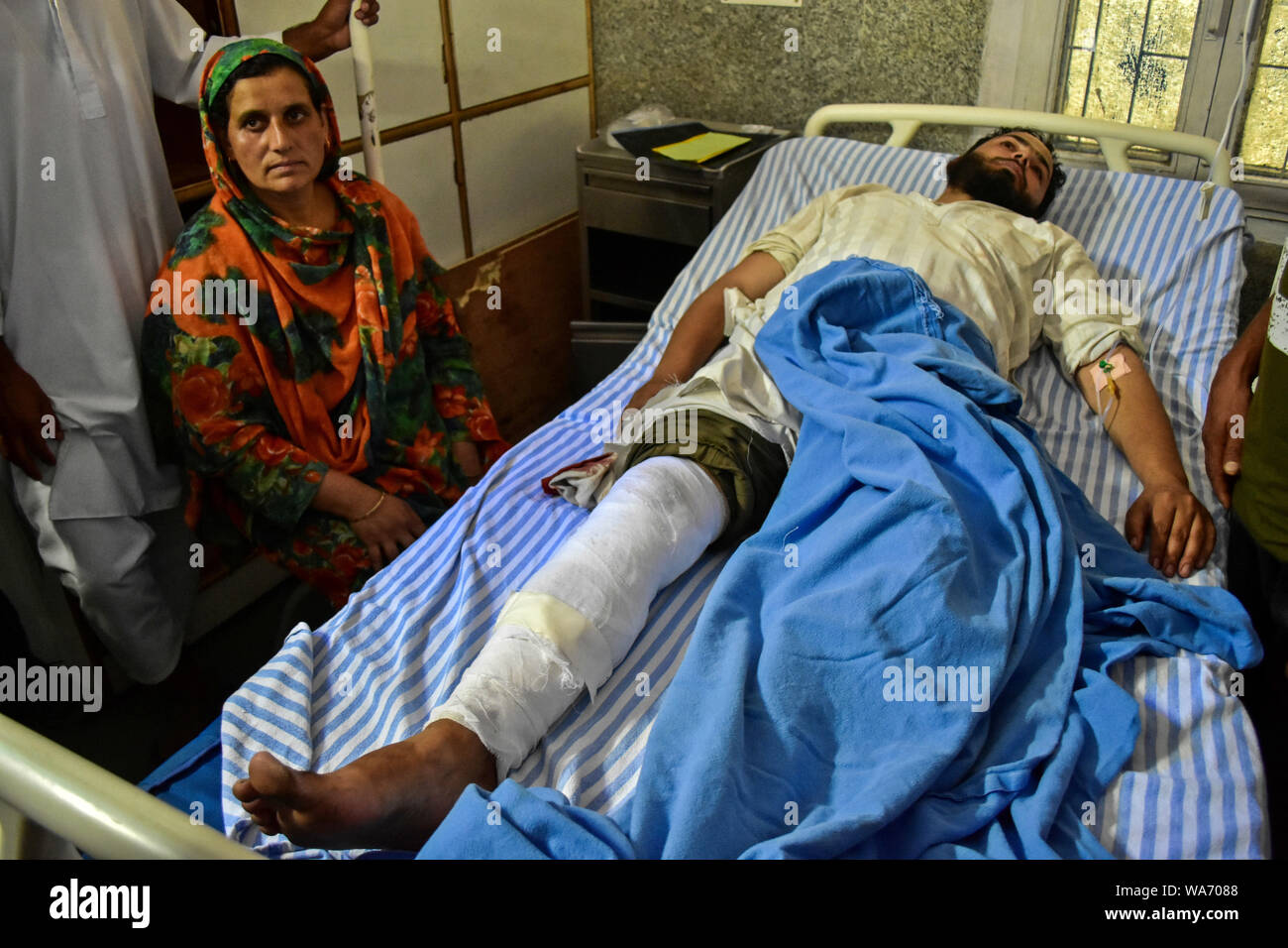 Un ferito il Kashmir protester posa su un letto di ospedale durante il coprifuoco a Srinagar.rigido coprifuoco e una totale comunicazione blackout in Kashmir valley in seguito alla decisione presa dal governo centrale di rottami di articolo 370 che concede uno statuto speciale di Jammu e Kashmir. Foto Stock