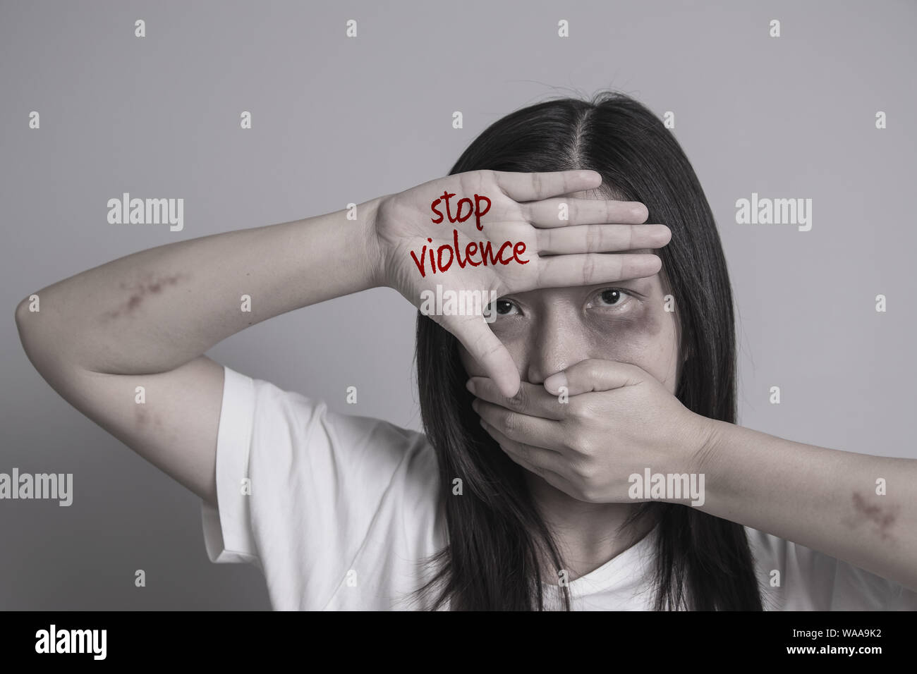 Stop alla violenza contro le donne campagna. Asia donna con livido sulle braccia e viso usare una mano vicino la bocca e l'altro lato scrivi la parola stop alla violenza Foto Stock