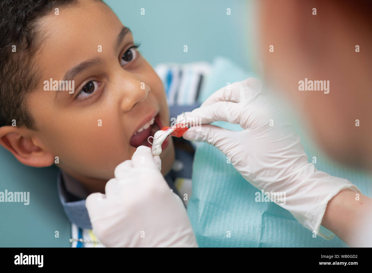 Ragazzo bocca di apertura mentre dentista mettendo protezione bocca Foto Stock