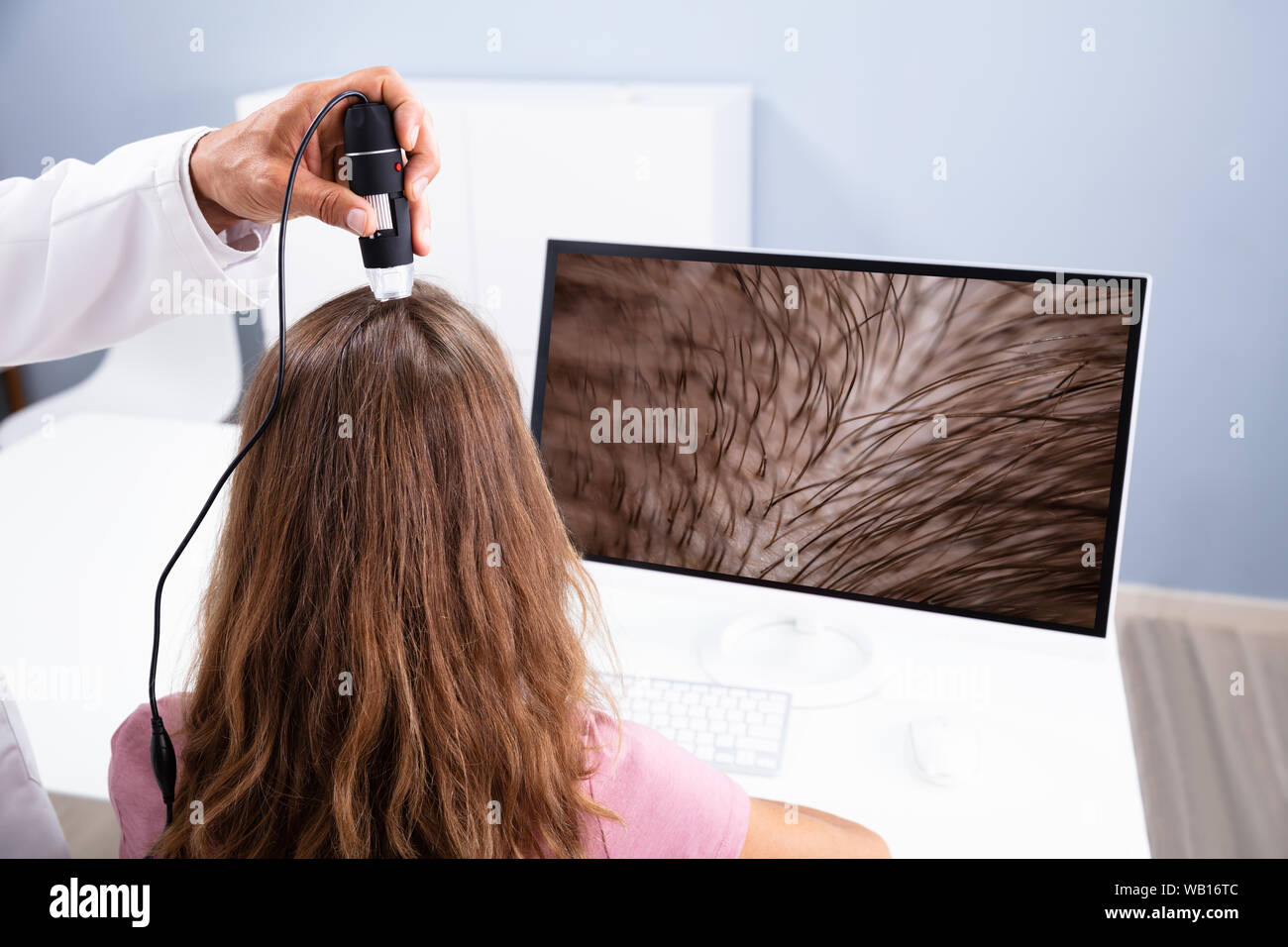 Close-up di dermatologo utilizzando Trichoscope per la caduta dei capelli il trattamento la sua clinica Foto Stock