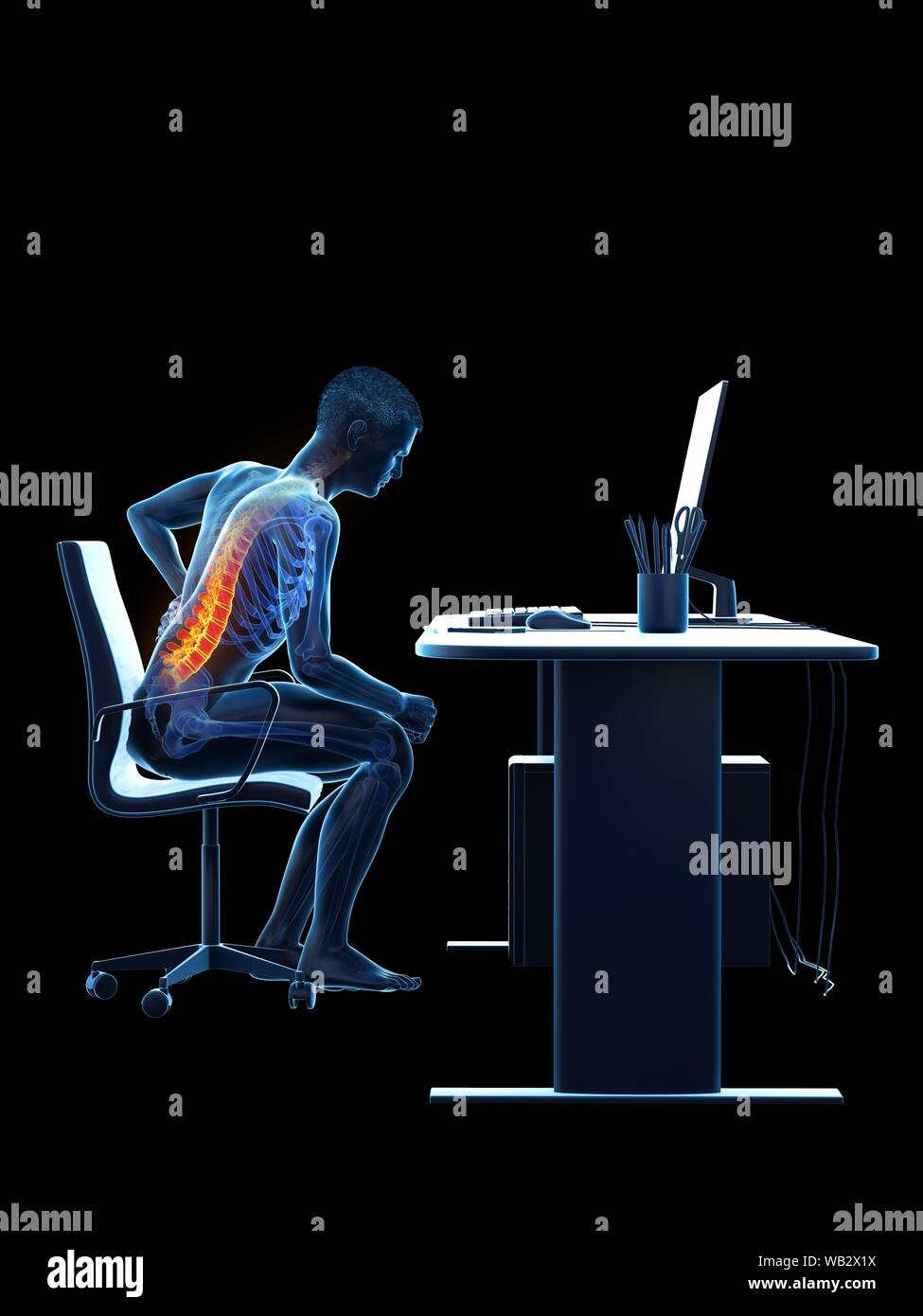 Dolore alla schiena a causa di seduta, illustrazione concettuale. Foto Stock