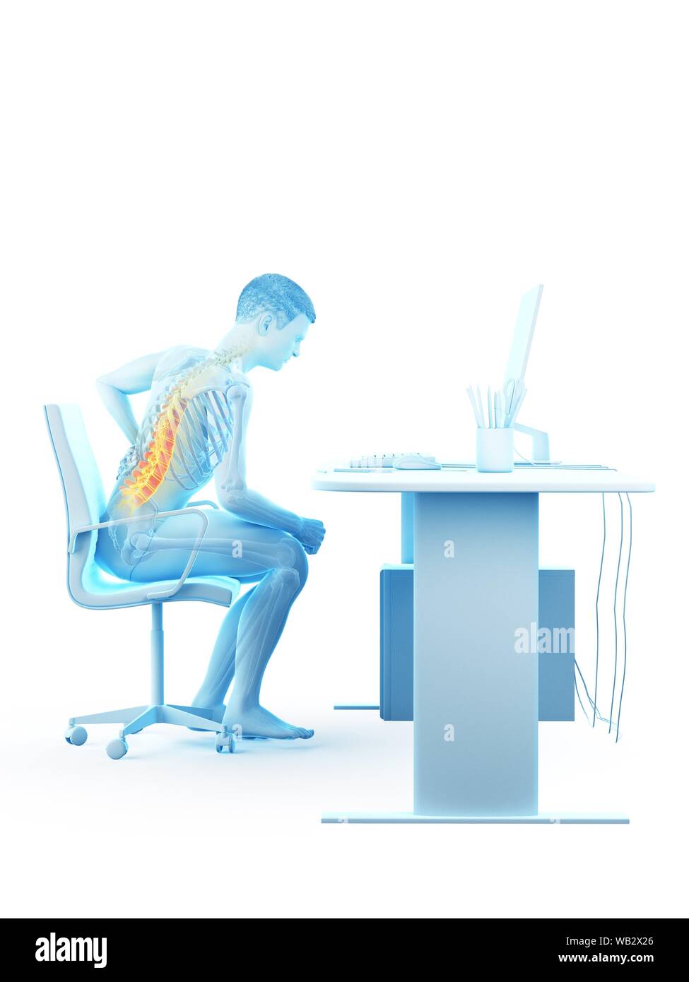 Dolore alla schiena a causa di seduta, illustrazione concettuale. Foto Stock
