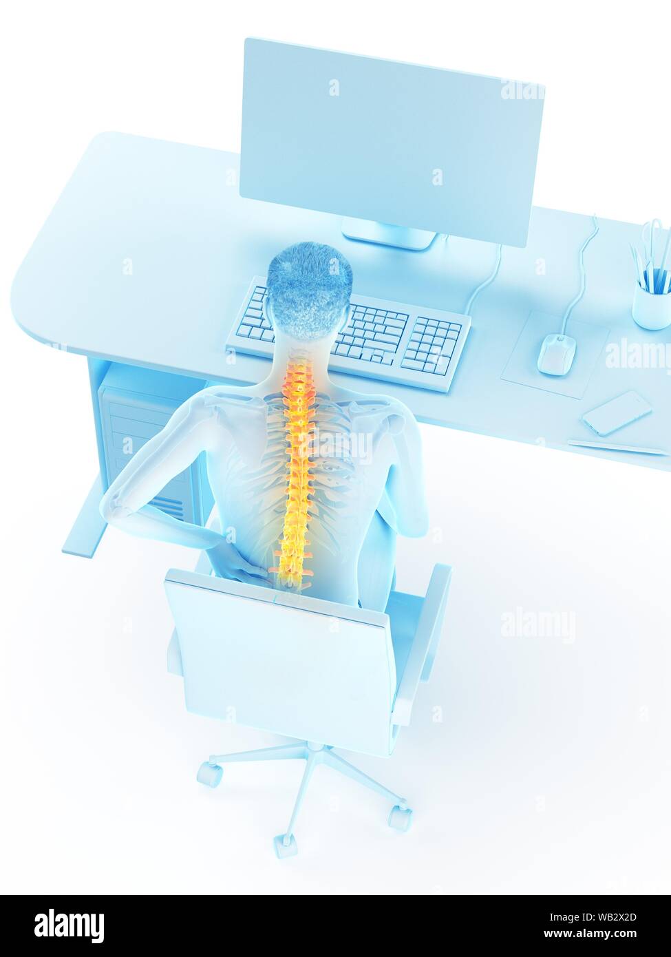 Dolore alla schiena a causa di seduta, illustrazione concettuale. Foto Stock
