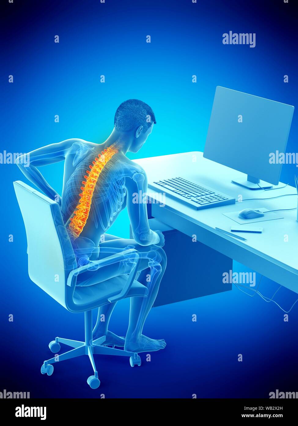 Dolore alla schiena a causa di seduta, illustrazione concettuale. Foto Stock