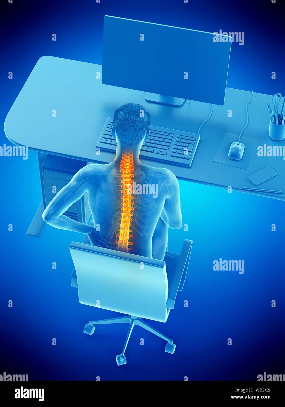 Dolore alla schiena a causa di seduta, illustrazione concettuale. Foto Stock